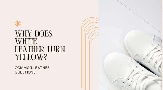 Image highlighting the article title 'Why Does White Leather Turn Yellow?' addressing common leather questions.